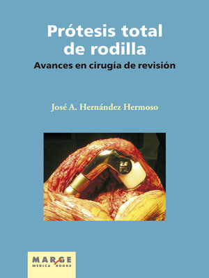 cover image of Avances en cirugía de revisión de la prótesis total de rodilla